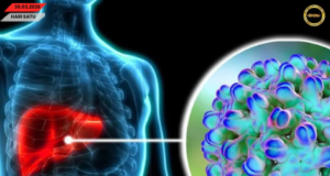Ubat antibodi monoklonal hepatitis D keterubah di dunya berengkah dikena di Beijing