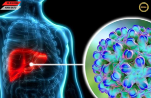 Ubat antibodi monoklonal hepatitis D keterubah di dunya berengkah dikena di Beijing